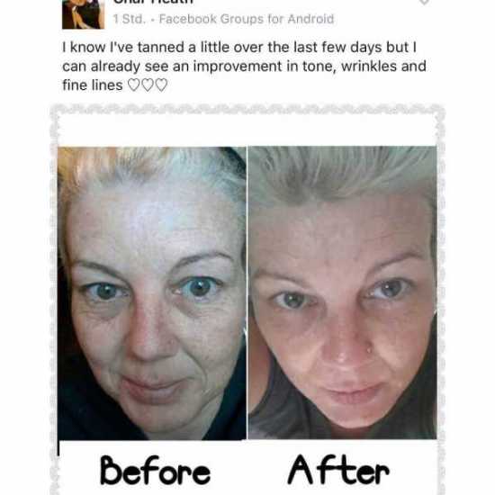 Face Lift Cream – Freshly Made – 100% Food, 0 Chemicals. Results beyond compare.